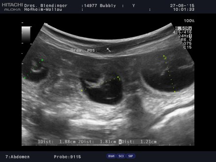 14977-_Bubbly_20150827_Abdomen_0003