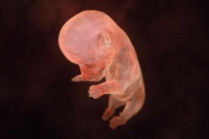 entwicklung_tag38-300x200